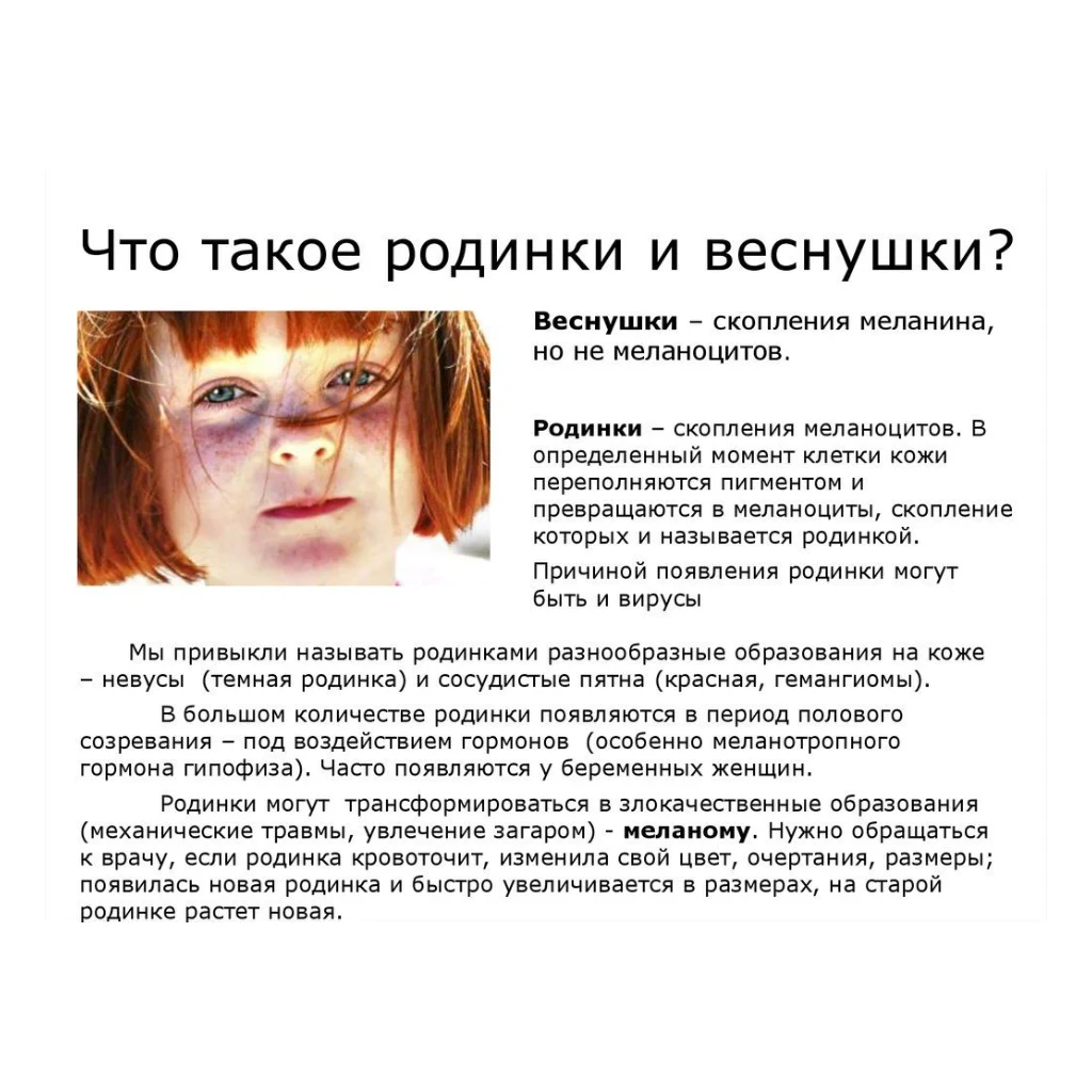 Пч.Веснушки 3-кг — фото 1